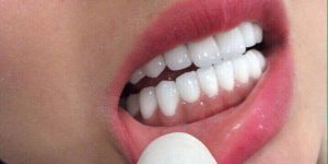 Chi phí bọc răng sứ Cercon bao nhiêu tiền ?