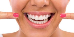 Tẩy trắng răng nên dùng loại thuốc nào ?