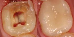 Răng bị nhức thì phải làm sao ?